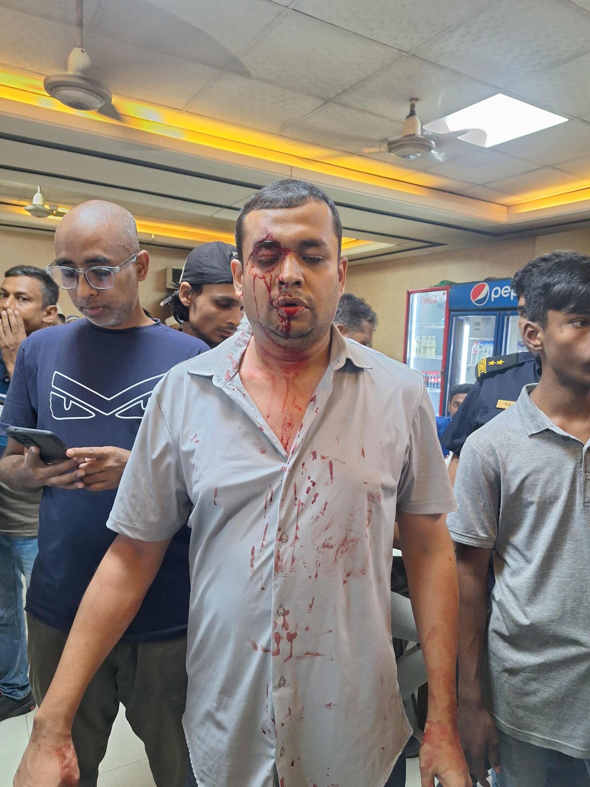 বনানী স্টার কাবাব এন্ড রেস্টুরেন্টে কাচ্চির সাথে পঁচা টিক্কা দেওয়ার প্রতিবাদ করায় আমি ওদের স্টাফদের দ্বারা মারধরের শিকার হই।